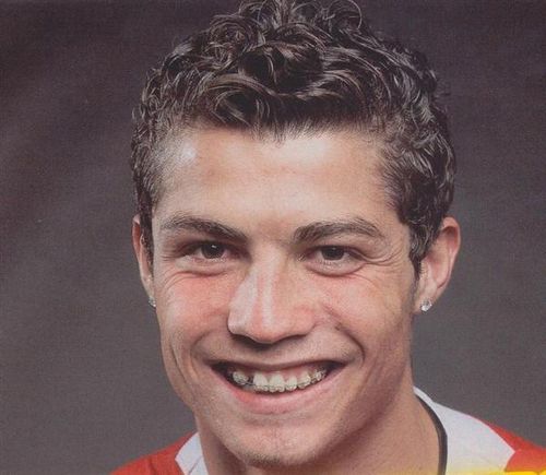 Cristiano Ronaldo Teeth Braces